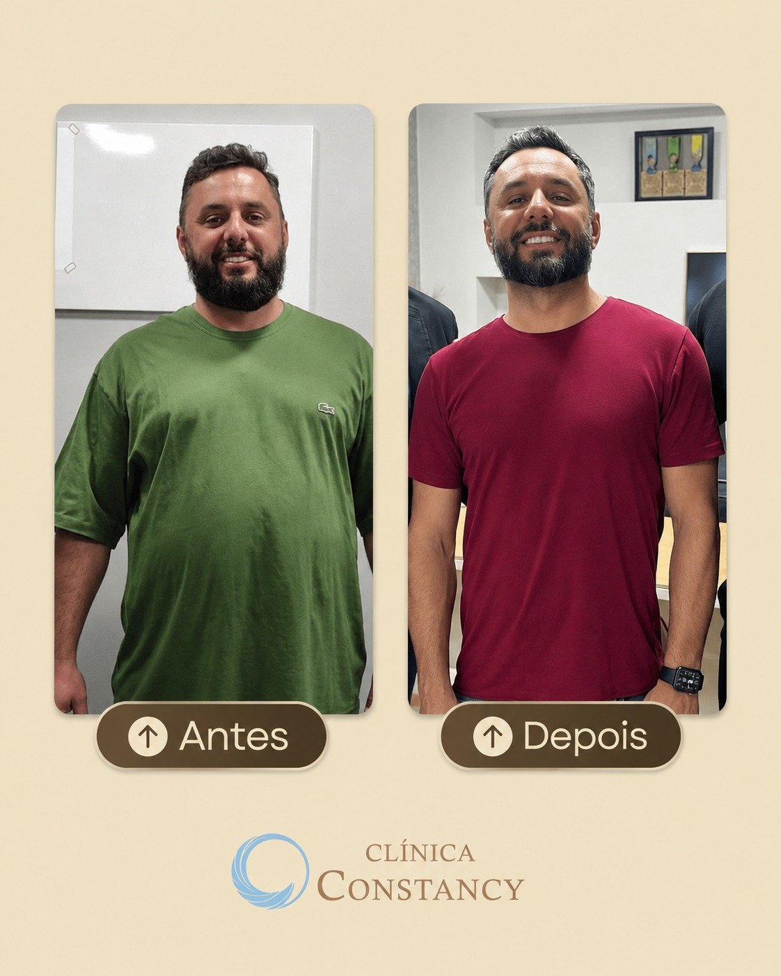 Antes e depois de paciente