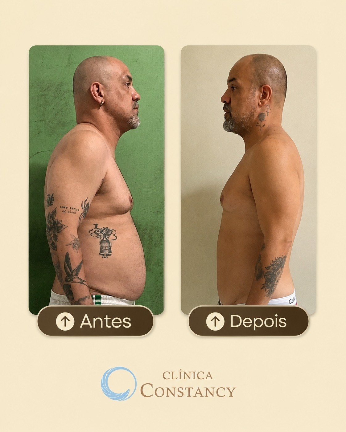 Antes e depois de paciente