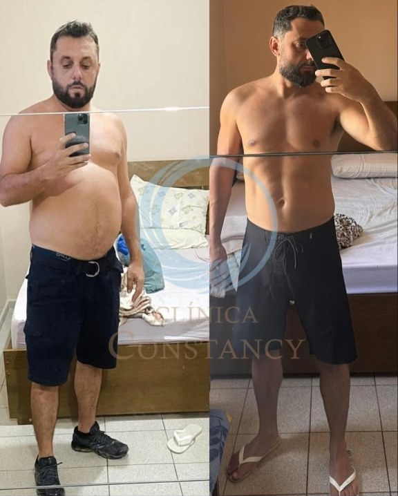 Antes e depois de paciente