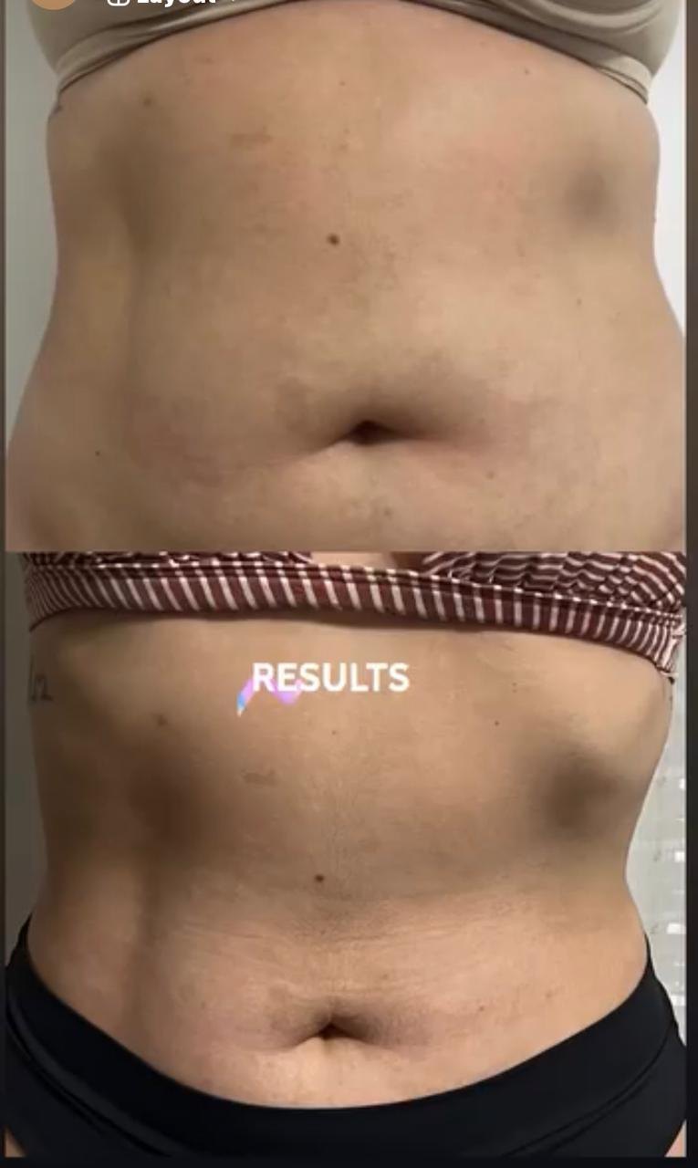 Antes e depois de paciente
